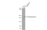 Thrombospondin 2 Antibody in Western Blot (WB)