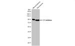 C1 inhibitor Antibody in Western Blot (WB)