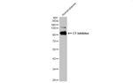 C1 inhibitor Antibody in Western Blot (WB)