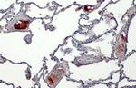 C1 inhibitor Antibody in Immunohistochemistry (Paraffin) (IHC (P))