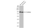 C1 inhibitor Antibody in Western Blot (WB)