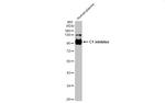 C1 inhibitor Antibody in Western Blot (WB)