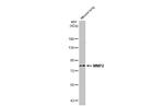 MMP2 Antibody in Western Blot (WB)