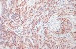 DUT Antibody in Immunocytochemistry (ICC/IF)