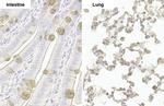 NUP62 Antibody in Immunohistochemistry (Paraffin) (IHC (P))