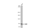 RRM1 Antibody in Western Blot (WB)