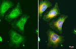 RRM1 Antibody in Immunocytochemistry (ICC/IF)