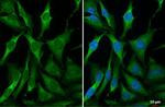 RRM2 Antibody in Immunocytochemistry (ICC/IF)