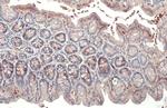 RRM2 Antibody in Immunohistochemistry (Paraffin) (IHC (P))