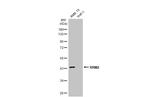 RRM2 Antibody in Western Blot (WB)