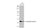 Thymidylate Synthase Antibody in Western Blot (WB)