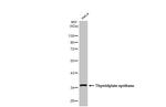 Thymidylate Synthase Antibody in Western Blot (WB)