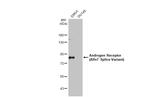 Androgen Receptor (ARv7 Splice Variant) Antibody in Western Blot (WB)