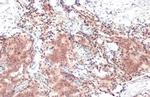 Androgen Receptor (ARv7 Splice Variant) Antibody in Immunohistochemistry (Paraffin) (IHC (P))