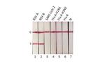 RSV NP Antibody in Lateral Flow (LF)