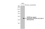 RSV NP Antibody in Western Blot (WB)