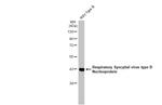 RSV NP Antibody in Western Blot (WB)