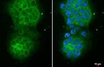 CYLD Antibody in Immunocytochemistry (ICC/IF)