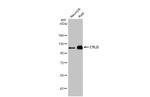 CYLD Antibody in Western Blot (WB)