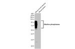 Intestinal Alkaline Phosphatase Antibody in Western Blot (WB)