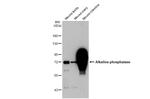 Intestinal Alkaline Phosphatase Antibody in Western Blot (WB)