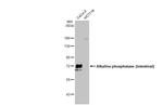 Intestinal Alkaline Phosphatase Antibody in Western Blot (WB)