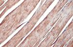 V-ATPase H Antibody in Immunohistochemistry (Paraffin) (IHC (P))