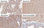 V-ATPase H Antibody in Immunohistochemistry (Paraffin) (IHC (P))