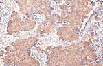 GSPT1 Antibody in Immunohistochemistry (Paraffin) (IHC (P))