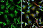 YTHDF2 Antibody in Immunocytochemistry (ICC/IF)