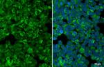 STAR Antibody in Immunocytochemistry (ICC/IF)