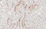 STAR Antibody in Immunohistochemistry (Paraffin) (IHC (P))