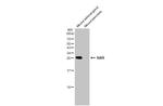 STAR Antibody in Western Blot (WB)