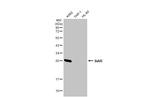 STAR Antibody in Western Blot (WB)