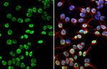 PARP1 Antibody in Immunocytochemistry (ICC/IF)