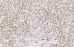 PARP1 Antibody in Immunohistochemistry (Paraffin) (IHC (P))