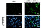 SARS-CoV-2 NSP5 Antibody in Immunocytochemistry (ICC/IF)