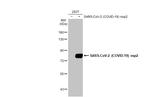 SARS-CoV-2 NSP2 Antibody in Western Blot (WB)