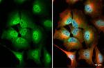 MRE11 Antibody in Immunocytochemistry (ICC/IF)