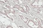 MRE11 Antibody in Immunohistochemistry (Paraffin) (IHC (P))