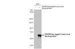 Lassa Virus Nucleoprotein Antibody in Western Blot (WB)