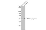 Fibrinogen gamma Antibody in Western Blot (WB)