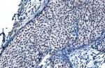 SP1 Antibody in Immunohistochemistry (Paraffin) (IHC (P))