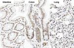 SP1 Antibody in Immunohistochemistry (Paraffin) (IHC (P))