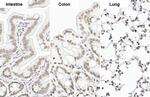 SP1 Antibody in Immunohistochemistry (Paraffin) (IHC (P))