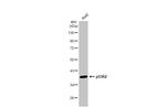 p53R2 Antibody in Western Blot (WB)