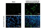 SARS-CoV-2 NSP12 Antibody in Immunocytochemistry (ICC/IF)