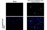 SARS-CoV-2 NSP12 Antibody in Immunocytochemistry (ICC/IF)