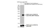 SARS-CoV-2 Spike (N501Y Mutant) Antibody in Western Blot (WB)