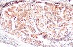 GSDMD Antibody in Immunohistochemistry (Paraffin) (IHC (P))